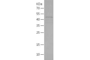 RCN2 Protein (AA 26-317) (His tag)