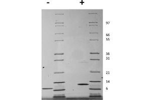 SDS-PAGE of Mouse Interleukin-15 Recombinant Protein SDS-PAGE of Mouse Interleukin-15 Recombinant Protein.