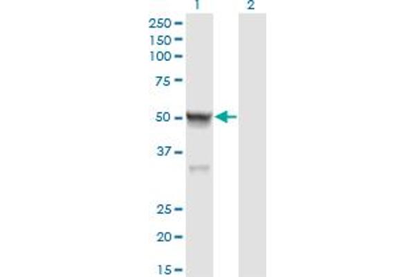 CASQ2 antibody  (AA 20-399)