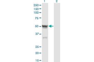 Western Blot analysis of CASQ2 expression in transfected 293T cell line by CASQ2 monoclonal antibody (M01), clone 1B6. (CASQ2 antibody  (AA 20-399))