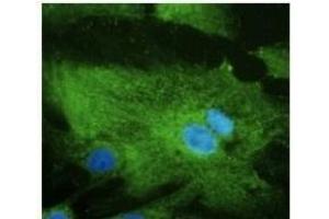 Anti-Rabll Ab at 1/500 dilution, Hepa cell line lysates at 100 µg per Iane, rabbit polyclonal to goat lµg (HRP) at 1/10,000 dilution, (RAB32 antibody  (C-Term))