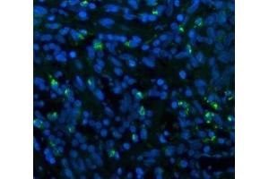 IF analysis of CD68 using anti-CD68 antibody (ABIN7600142). (CD68 antibody  (AA 154-354))