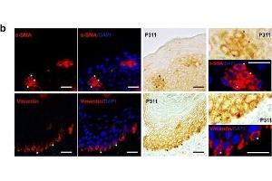 Expression patterns of vimentin, α-SMA, and P311 in the epidermis of human burn wounds. (NREP antibody  (AA 25-68))