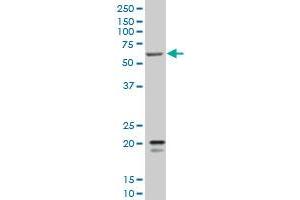 SMARCD3 monoclonal antibody (M02), clone 5F12 Western Blot analysis of SMARCD3 expression in K-562 . (SMARCD3 antibody  (AA 385-483))