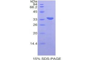 SDS-PAGE analysis of Mouse CDK7 Protein.
