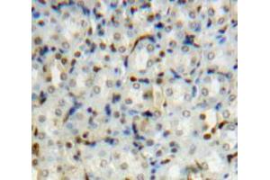 Used in DAB staining on fromalin fixed paraffin-embedded Kidney tissue (PIN1 antibody  (AA 2-163))
