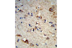 Formalin-fixed and paraffin-embedded human brain tissue reacted with EXT2 Antibody (Center), which was peroxidase-conjugated to the secondary antibody, followed by DAB staining.