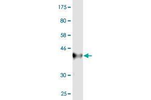 Western Blot detection against Immunogen (36. (IGDCC4 antibody  (AA 1152-1250))