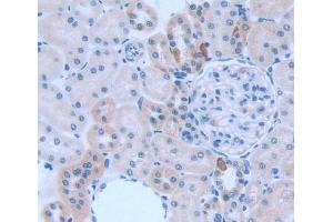 Used in DAB staining on fromalin fixed paraffin- embedded kidney tissue (KNG1 antibody  (AA 19-380))