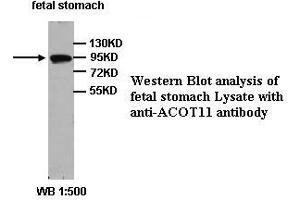 Image no. 1 for anti-Acyl-CoA Thioesterase 11 (ACOT11) (Internal Region) antibody (ABIN791080) (ACOT11 antibody  (Internal Region))