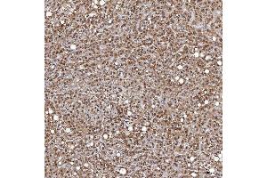 IHC analysis of TRMT61A using anti-TRMT61A antibody (ABIN7599220). (TRMT61A antibody  (AA 1-289))