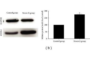 (a) Immunohistochemical staining of CHI3L1 on sections of arterial vessels in control group and research group. (CHI3L1 antibody  (AA 301-383))