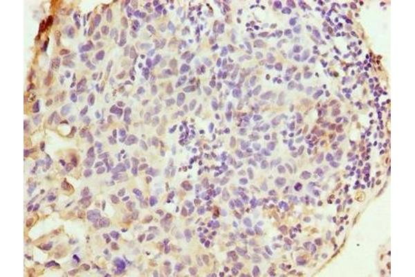 WDR62 antibody  (AA 889-1188)