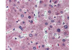 HYAL1 antibody was used for immunohistochemistry at a concentration of 4-8 ug/ml. (HYAL1 antibody  (N-Term))