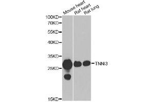 Western blot analysis of extracts of various cell lines, using TNNI3 antibody (ABIN2560479) at 1:1000 dilution. (TNNI3 antibody)