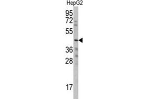 Western Blotting (WB) image for anti-Wnt1 Inducible Signaling Pathway Protein 3 (WISP3) antibody (ABIN3002571) (WISP3 antibody)