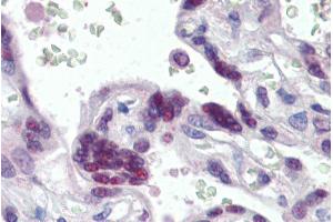 Immunohistochemistry (IHC) image for anti-Mortality Factor 4 Like 1 (MORF4L1) (N-Term) antibody (ABIN185075)