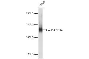 Western blot analysis of extracts of LNCaP cells, using SLC4 / NBC antibody (ABIN6129130, ABIN6148013, ABIN6148014 and ABIN6220962) at 1:1000 dilution. (SLC4A4 antibody  (AA 1-240))