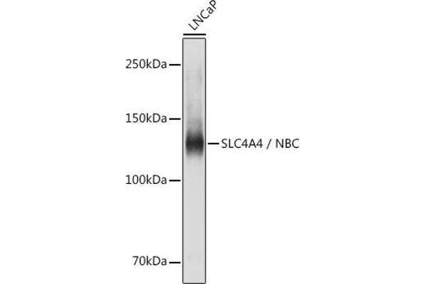 SLC4A4 antibody  (AA 1-240)