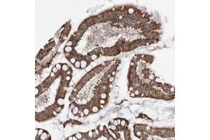 Immunohistochemical staining of human small intestine with TMPRSS11F polyclonal antibody  strong cytoplasmic positivity in glandular cells at 1:50-1:200 dilution.