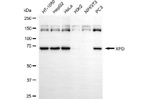 Western blotting analysis using XPD antibody (ABIN7798540).