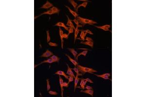 Immunofluorescence (IF) image for anti-Legumain (LGMN) (AA 18-323) antibody (ABIN6143172)