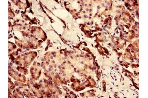 Immunohistochemistry analysis of human pancreatic tissue using ABIN7147553 at dilution of 1:100 (CHID1 antibody  (AA 20-393))