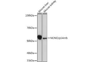 Western blot analysis of extracts of various cell lines, using NONO/p54nrb Rabbit mAb (ABIN7268947) at 1:1000 dilution. (NONO antibody)