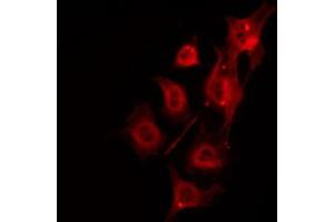 ABIN6266877 staining Hela by IF/ICC. (DMPK antibody  (N-Term))
