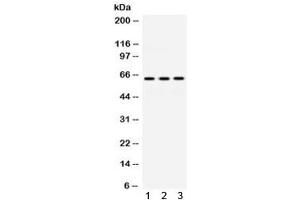 Western blot testing of human 1) HeLa, 2) Jurkat and 3) HUT lysate with EME1 antibody.