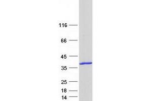 Validation with Western Blot (SULT1A2 Protein (Transcript Variant 2) (Myc-DYKDDDDK Tag))