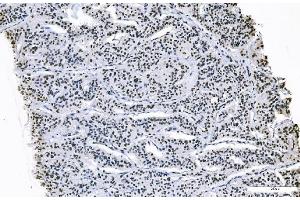 IHC analysis of FOXK1 using anti-FOXK1 antibody (ABIN7600295). (Foxk1 antibody  (AA 175-671))