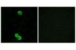 Immunofluorescence analysis of MCF-7 cells, using RPL3L antibody. (RPL3L antibody)