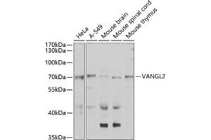 Western blot analysis of extracts of various cell lines, using V antibody (ABIN6132779, ABIN6150054, ABIN6150055 and ABIN6223794) at 1:1000 dilution. (VANGL2 antibody  (AA 1-110))