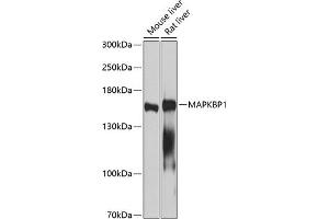 Western blot analysis of extracts of various cell lines, using M antibody (ABIN3016334, ABIN3016335, ABIN5664104 and ABIN6219724) at 1:1000 dilution.