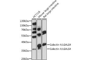 Western blot analysis of extracts of various cells, using Galectin 4/LG antibody (ABIN7267339) at 1:1000 dilution. (GAL4 antibody  (AA 1-100))