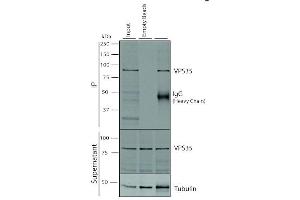 Immunoprecipitation analysis using Mouse Anti-VPS35 Monoclonal Antibody, Clone 5A9 (ABIN6932951).