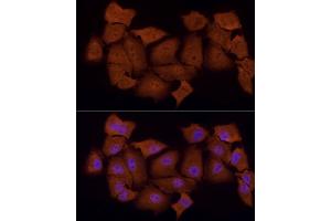 Immunofluorescence analysis of A-549 cells using PSMC5 Rabbit mAb (ABIN7269585) at dilution of 1:50 (40x lens).