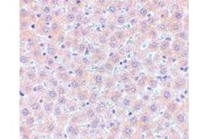 Immunohistochemistry of TNFSF11 in human liver tissue with TNFSF11 polyclonal antibody  at 5 ug/mL .