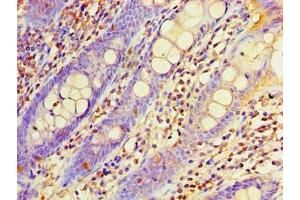 Immunohistochemistry of paraffin-embedded human colon tissue using ABIN7162957 at dilution of 1:100 (EHHADH antibody  (AA 1-723))