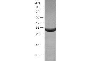 Western Blotting (WB) image for Activator of HSP90 ATPase Activity 1 (AHSA1) (AA 1-338) protein (His tag) (ABIN7287830) (AHSA1 Protein (AA 1-338) (His tag))