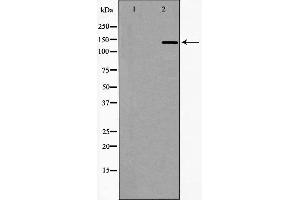 Western blot analysis of extracts of Jurkat, using DCTN1 antibody. (Dynactin 1 antibody  (C-Term))