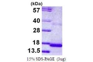 SDS-PAGE (SDS) image for Cystatin 9 (Testatin) (CST9) (AA 29-159) protein (His tag) (ABIN667589)