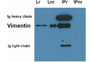 Immunoprecipitation of vimentin from HeLa cell lysate by antibody VI-10 (Vimentin antibody)