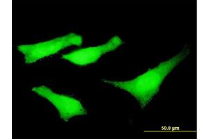 Immunofluorescence of monoclonal antibody to SYNE2 on HeLa cell. (SYNE2 antibody  (AA 6702-6799))