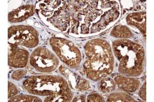 Image no. 4 for anti-B and T Lymphocyte Associated (BTLA) antibody (ABIN1496983)