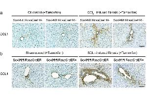 Immunohistochemistry (IHC) image for anti-Collagen, Type I (COL1) antibody (ABIN135046)
