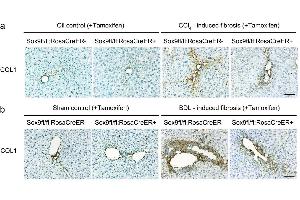 Characterisation of COL1 expression in control and Sox9-null animals following liver fibrosis induction using ABIN135046.