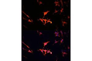 Immunofluorescence (IF) image for anti-Late Endosomal/lysosomal Adaptor, MAPK and mTOR Activator 1 (LAMTOR1) (AA 1-161) antibody (ABIN6143083)