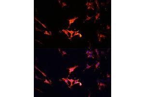 Immunofluorescence analysis of C6 cells using L Polyclonal Antibody (ABIN6133274, ABIN6143083, ABIN6143084 and ABIN6215309) at dilution of 1:100 (40x lens). (LAMTOR1 antibody  (AA 1-161))